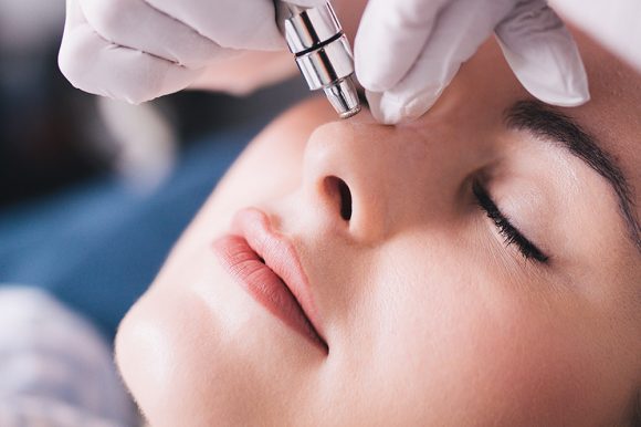 Skin Micro-Needling 